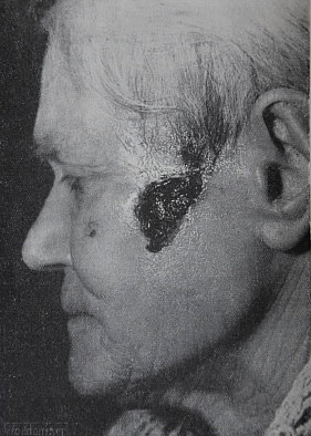 Georges Lakhovsky MWO