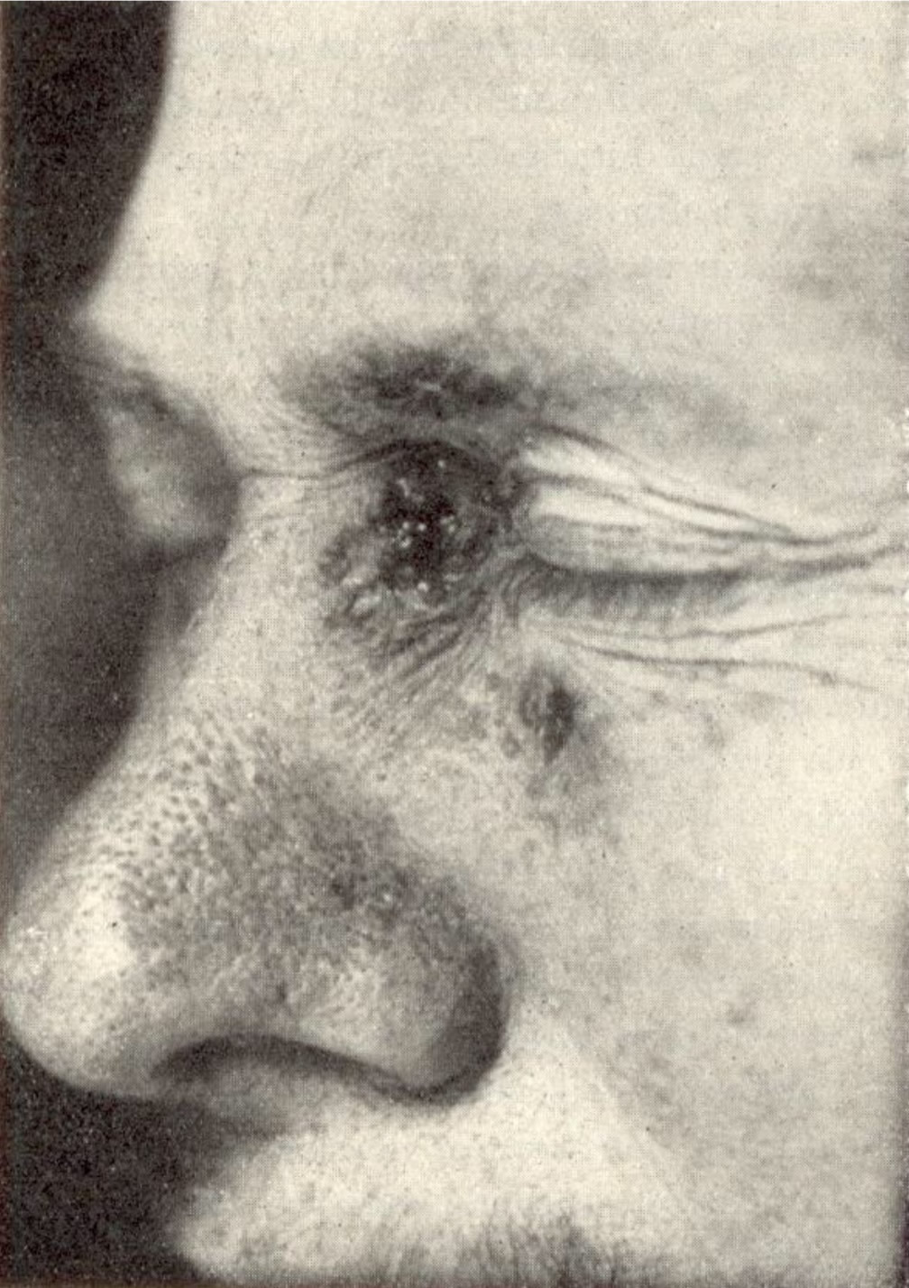 Georges Lakhovsky MWO